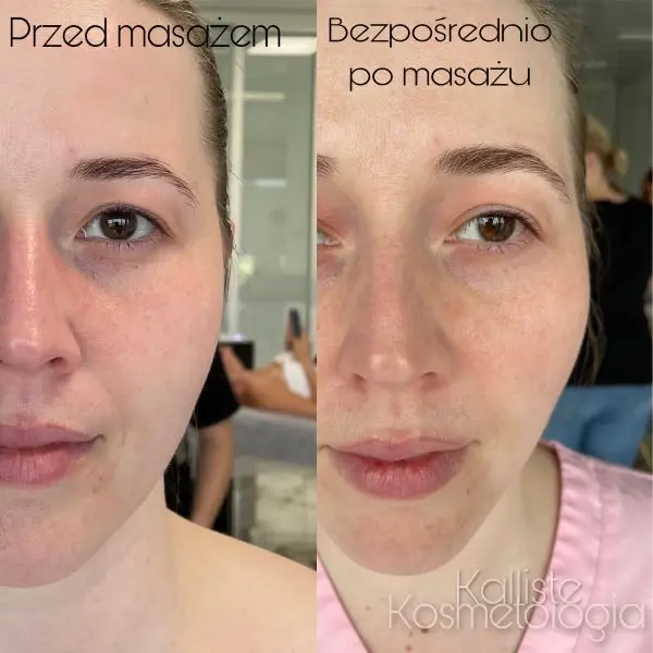 Skóra po masażu Kobido Sędziszów Małopolski