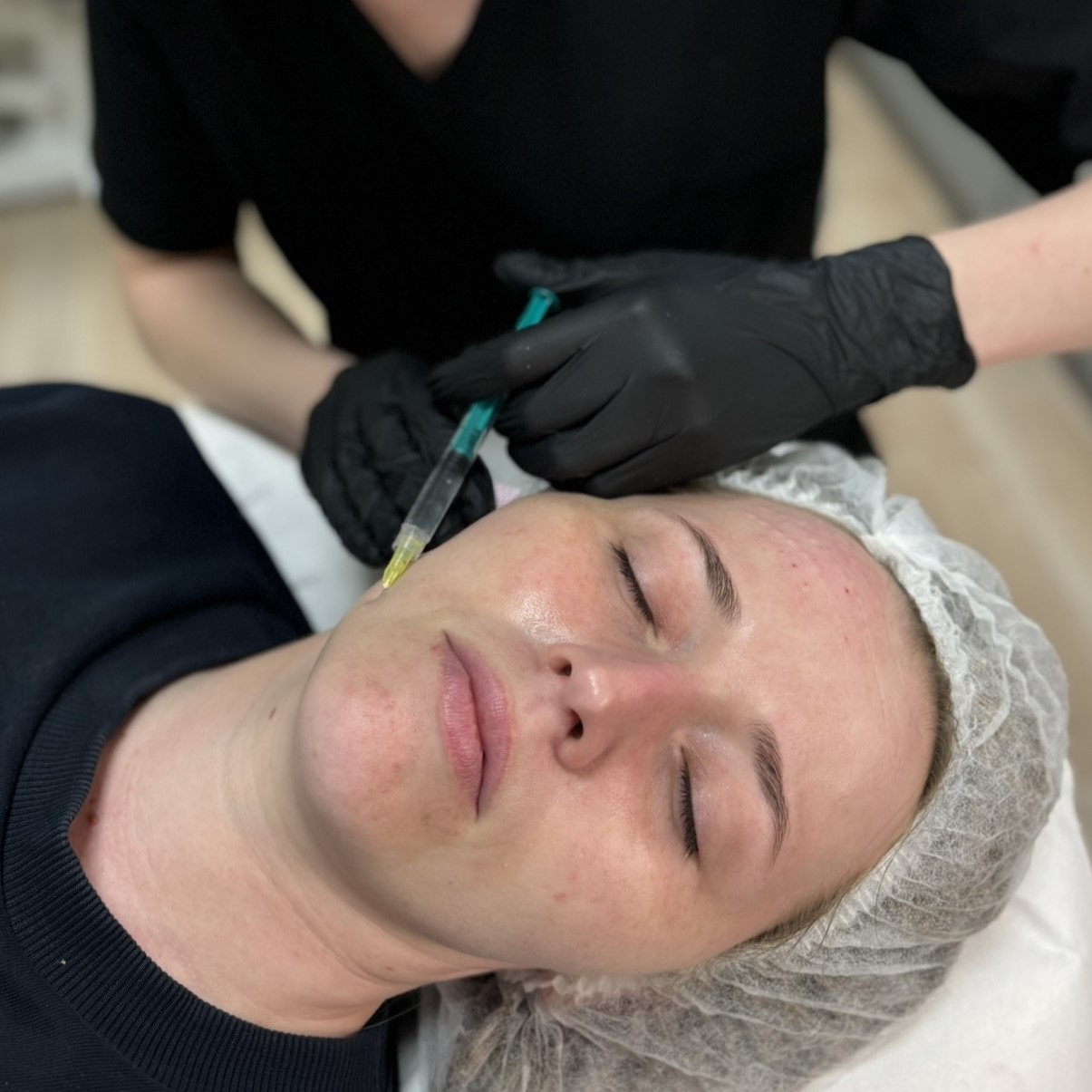 Mezoterapia igłowa twarzy w Kalliste Sędziszów Małopolski