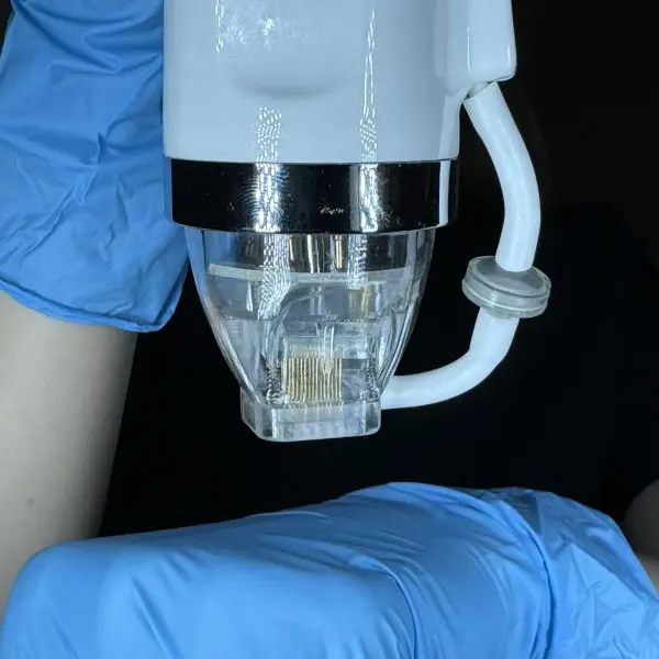 Zaawansowane urządzenie kosmetologiczne do radiofrekfencji mikroigłowej - wyszczuplenie sylwetki i ujędrnienie skóry w Rzeszowie